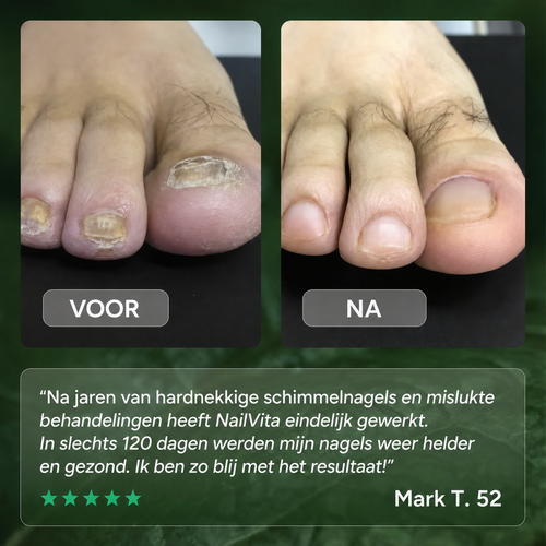 Behandelpen tegen voetschimmel